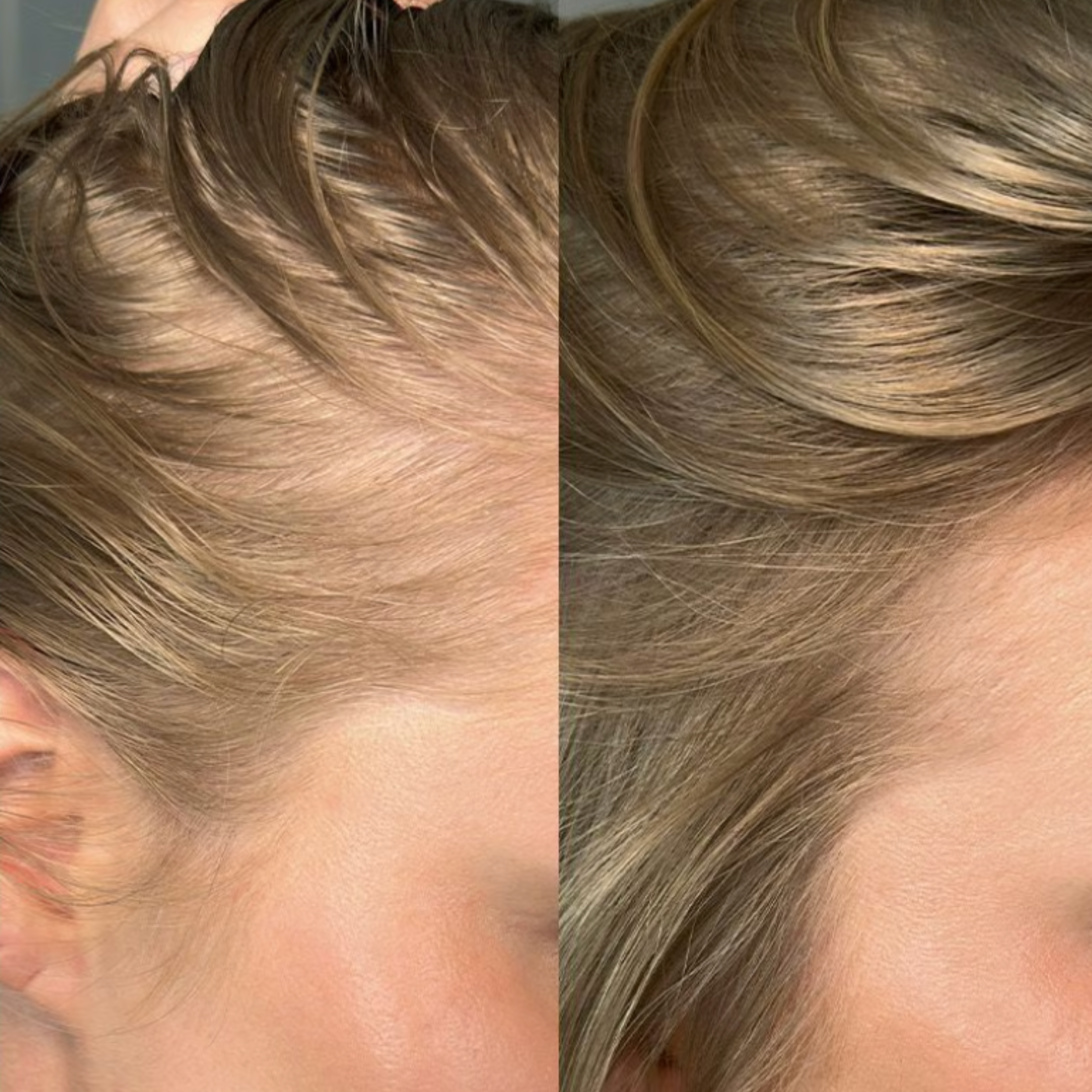 Novalora Hair Growth Serum